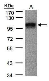 DAP5 Rabbit Polyclonal Antibody