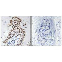 DAPK3 Antibody
