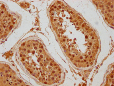 DAXX Antibody