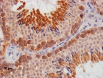 DAZL Antibody