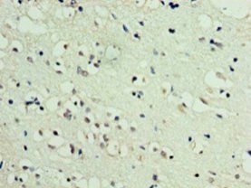DBNDD2 Antibody