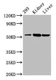 DBT Antibody