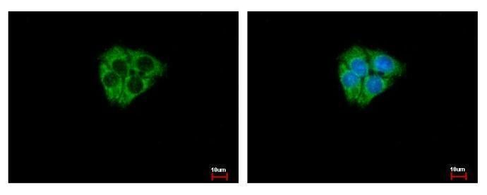 DCAMKL2 Rabbit Polyclonal Antibody