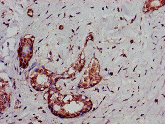 DCLK1 Antibody