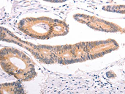 DCT Antibody