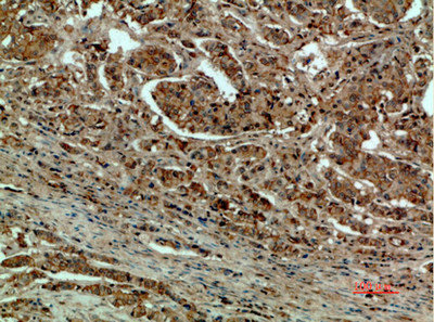DCT Antibody