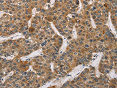 DCTN2 Antibody