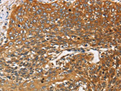 DCTN2 Antibody