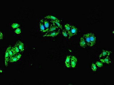 DCX Antibody