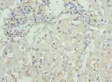 DCX Antibody
