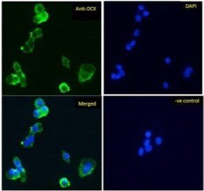 Doublecortin/DCX (aa232-242) Antibody