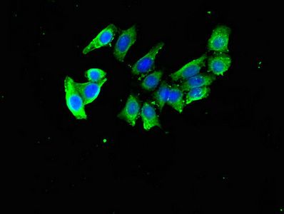 DDA1 Antibody
