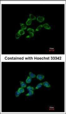 dimethylarginine dimethylaminohydrolase 1 Antibody