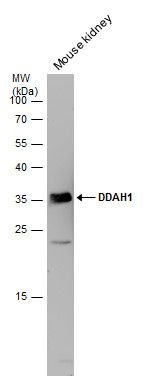 dimethylarginine dimethylaminohydrolase 1 Antibody