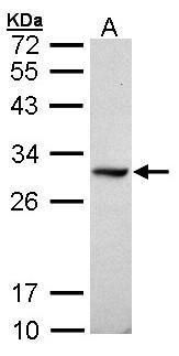 dimethylarginine dimethylaminohydrolase 1 Antibody