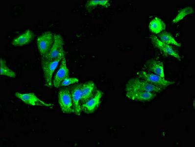 DDC Antibody