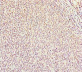 DDX11 Antibody