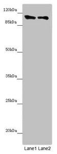 DDX11 Antibody