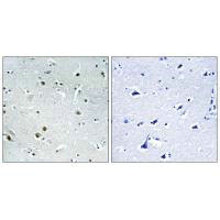 DDX24 Antibody