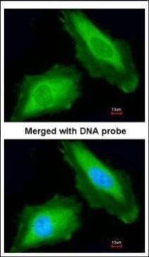 DDX3 antibody
