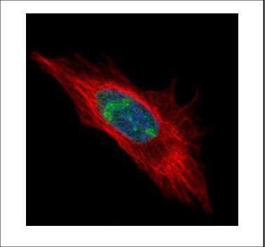 DDX56 Rabbit Polyclonal Antibody