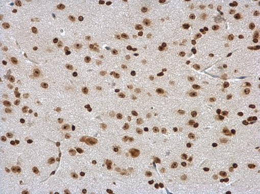 DDX56 Rabbit Polyclonal Antibody