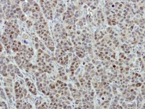 DDX56 Rabbit Polyclonal Antibody