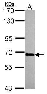 DDX56 Rabbit Polyclonal Antibody