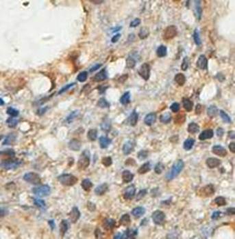 DDX5 Rabbit Polyclonal Antibody