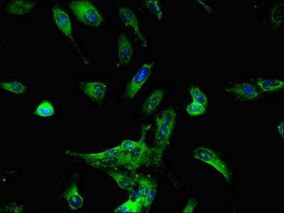 DDX6 Antibody