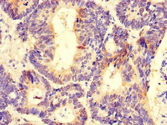 DDX6 Antibody