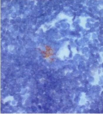 Dectin-2 Antibody
