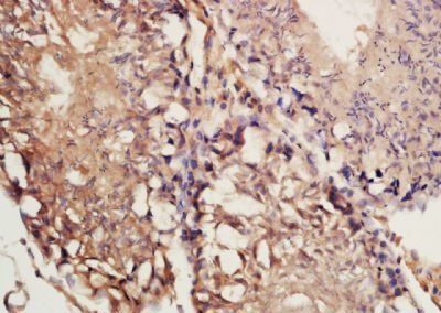 DEFB132 Rabbit Polyclonal Antibody