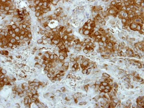 Deltex1 antibody [C1C3]