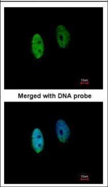 DENND1B Rabbit Polyclonal Antibody