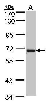 DENND1B Rabbit Polyclonal Antibody