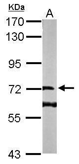 DENND1B Rabbit Polyclonal Antibody