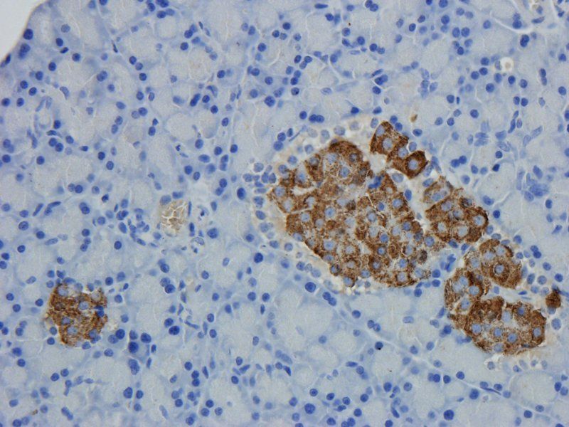 DEPDC1 Rabbit Polyclonal Antibody