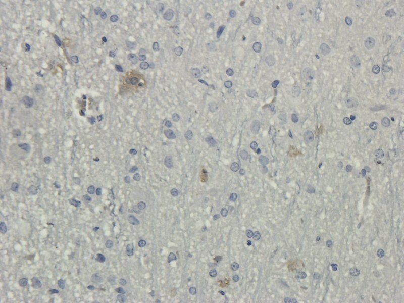 DEPDC1 Rabbit Polyclonal Antibody