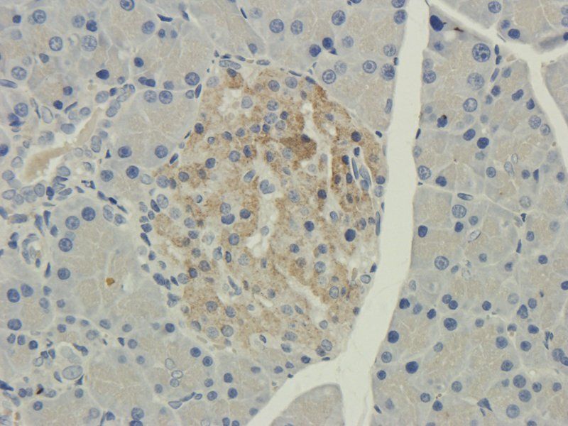 DEPDC1 Rabbit Polyclonal Antibody