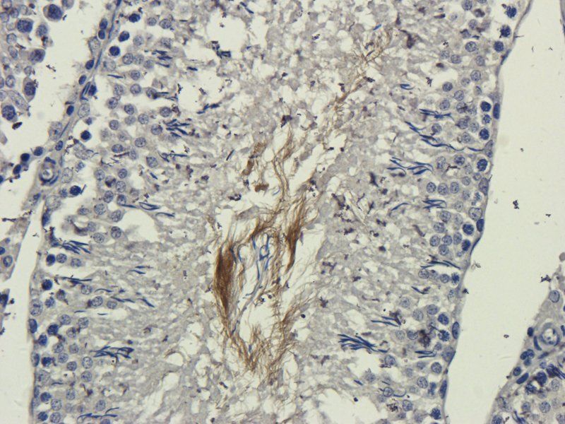 DEPDC1 Rabbit Polyclonal Antibody