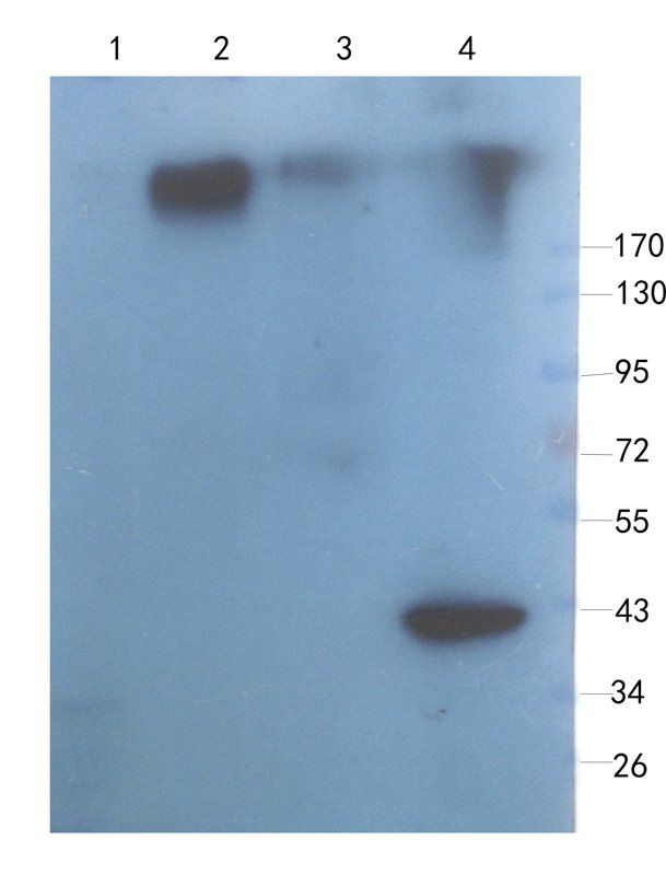 DEPDC1 Rabbit Polyclonal Antibody