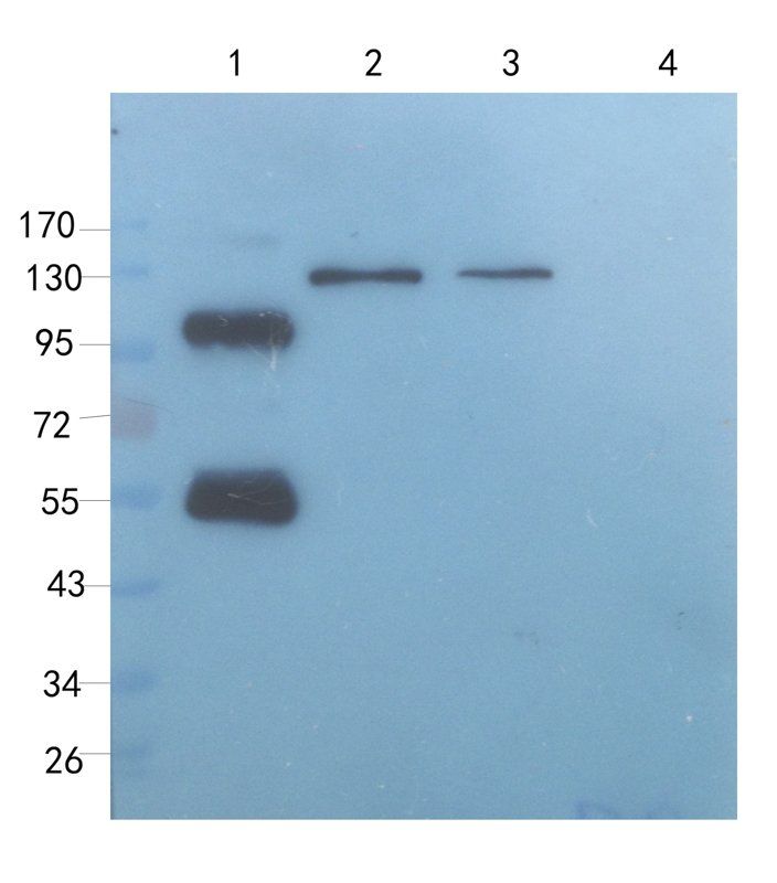 DEPDC1 Rabbit Polyclonal Antibody