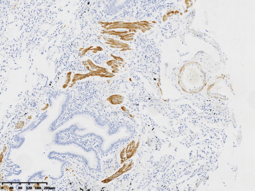 Desmin Antibody