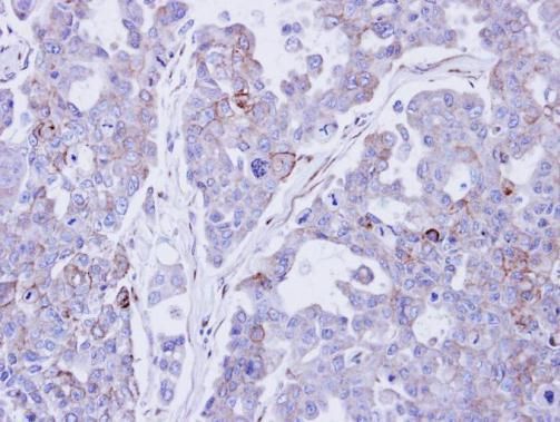 Desmocollin 2 Rabbit Polyclonal Antibody