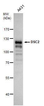 Desmocollin 2 Rabbit Polyclonal Antibody