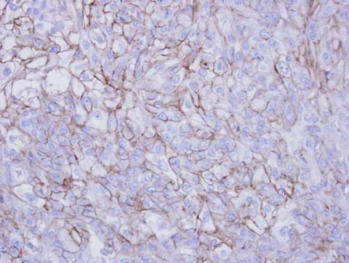 desmoglein 2 Antibody