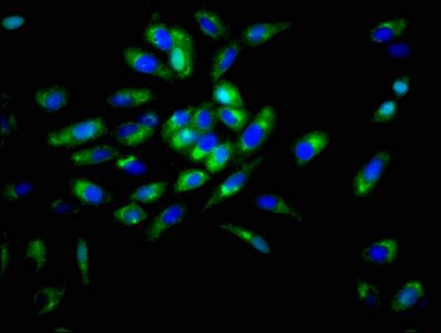 DSG3 Antibody