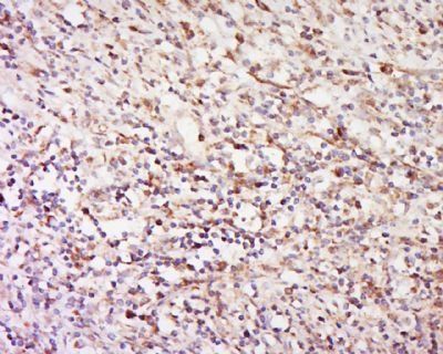 Desmoplakin I+II Rabbit Polyclonal Antibody