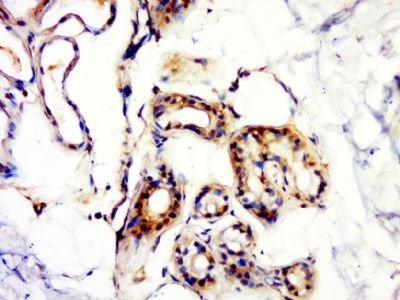 Desmoplakin I+II Rabbit Polyclonal Antibody